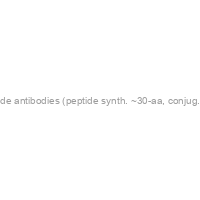 Custom Anti-Peptide antibodies (peptide synth. ~30-aa, conjug., 2 rabbits, ELISA & Aff. Purif.)